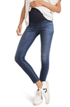 Madewell Maternity Over-the-belly Skinny Jeans In Danny