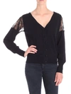 FUZZI BLACK CARDIGAN WITH LACE