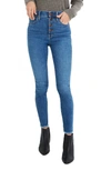 MADEWELL 10-INCH HIGH-RISE SKINNY JEANS: BUTTON-FRONT EDITION,AF687