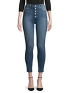 JOE'S JEANS BUTTON-FLY CROPPED JEANS,0400011986382