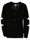 BURBERRY V-NECK BUTTONED CARDIGAN,11464476