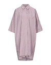 LIVIANA CONTI KNEE-LENGTH DRESSES,15077151HF 4