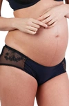 CACHE COEUR LOUISE EMBROIDERED MATERNITY SHORTS,SH2001