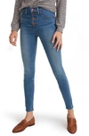MADEWELL BUTTON FRONT HIGH WAIST SKINNY JEANS,194340291027