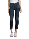 AMO Twist Skinny Ankle Jeans