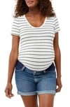 A Pea In The Pod Ruched Scoop Neck Maternity/postpartum Top In White/ Black Stripe