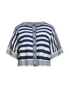 Elisabetta Franchi Woman Cardigan Bright Blue Size 8 Cotton, Viscose
