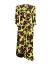 Vetements Woman Midi Dress Acid Green Size Xs Viscose