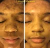 Admire My Skin Ultra Potent Brightening Serum Dark Spot Corrector In Clear