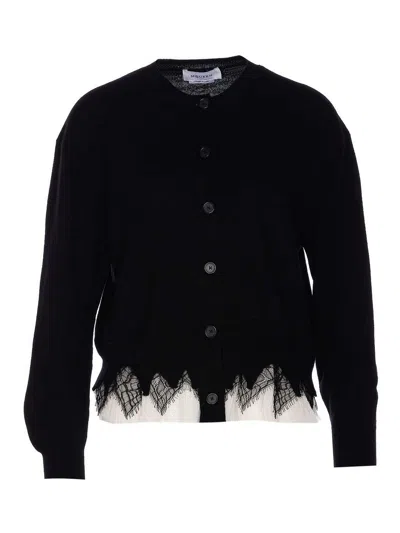 ALEXANDER MCQUEEN CÁRDIGAN - NEGRO