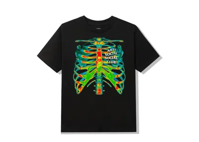 Pre-owned Anti Social Club Men's  Blow To The Chest T-shirt In Black