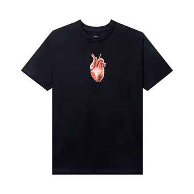 Pre-owned Anti Social Social Club I Don't Know Why Tee 'black' | Men's Size M