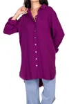 Before You Not So Basic Gauze Top In Orchid In Pink