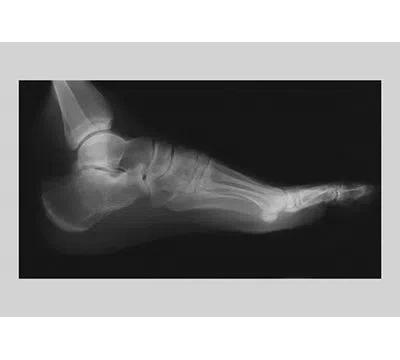 Buyenlarge Foot Photographic Print In Black;white