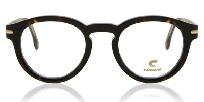 Carrera 313 Men's Glasses, Tortoiseshell, Size 47 In Black