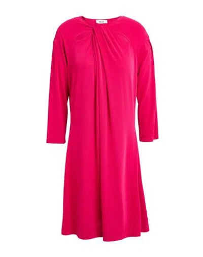 Dixie Woman Mini Dress Fuchsia Size M Polyester, Elastane In Pink
