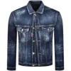 Dsquared2 Double Front Denim Jacket Blue In Blue