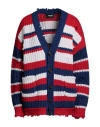 Dsquared2 Distressed Striped Chunky Knit Cardigan In Blue