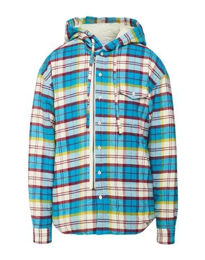 Facetasm Man Jacket Azure Size 5 Cotton In Blue