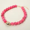 Fashnzfab Polished Metal Bean Accent Bold Marbled Ball Beaded Statement Necklace In Pink