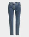 Ferragamo Laser Stone Washed Denim Slim-leg Ankle Jeans In Blue
