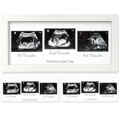 Keababies Trio Baby Sonogram Frame In Alpine White