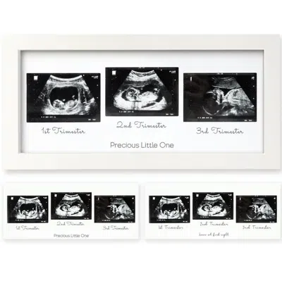 Keababies Kids' Trio Baby Sonogram Frame In Alpine White