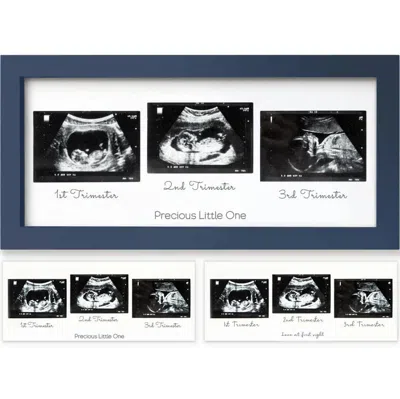 Keababies Trio Baby Sonogram Frame In Midnight Blue