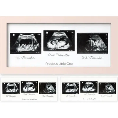 Keababies Kids'  Trio Baby Sonogram Frame In Petal Pink