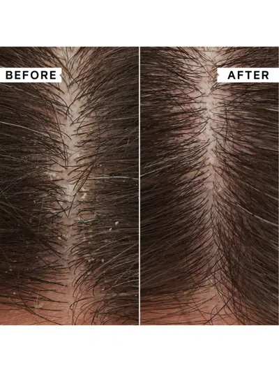 Philip Kingsley Flakyitchy Scalp Hydrating Conditioner, Size 200ml