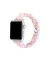 Posh Tech Kit Tortoise Resin Link Band For Apple Watch, Fits All Apple Watch Models In Blush Tortoise