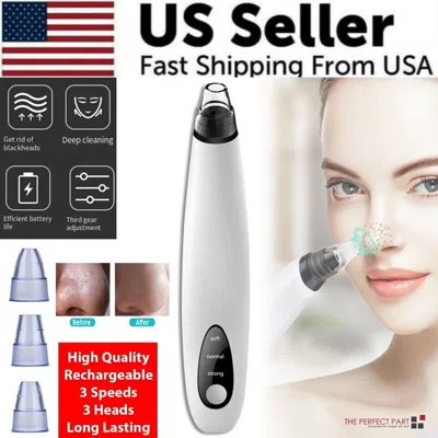 Proxxi Electric Blackhead Remover Cleaner Face Diamond Pore Vacuum Suction White Heads