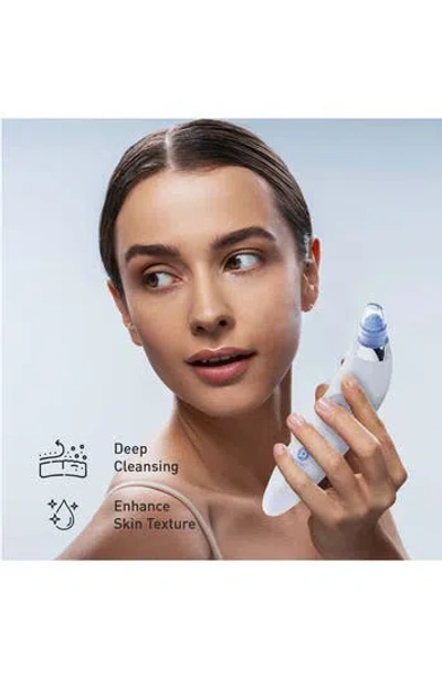 Pursonic Pore Vacuum Blackhead Remover In White