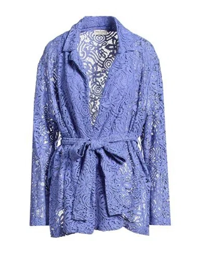 Rebel Queen By Liu •jo Woman Jacket Blue Size M Cotton, Viscose, Polyamide, Polyester