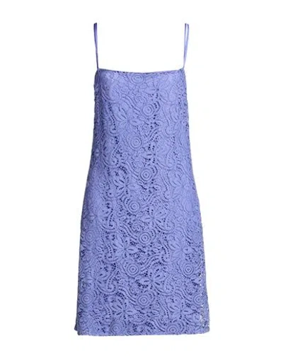 Rebel Queen By Liu •jo Woman Mini Dress Light Blue Size S Cotton, Viscose, Polyamide, Polyester, Ela