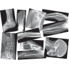 Roylco Inc Broken Bones X-rays Educational Tool