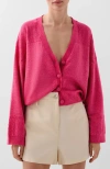 Scalpers Tran Buttons Cardigan In Pink