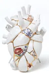 Seletti 'love In Bloom Kintsugi' Vase