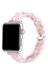 The Posh Tech Kit Tortoise Resin Link Apple Watch® Watchband In Blush Tortoise