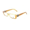Tod's Yellow Acetate Frames