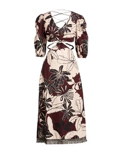 Twinset U & B Woman Midi Dress Cream Size Xl Cotton, Polyester In Multi