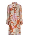 Twinset Woman Mini Dress Brown Size 10 Viscose, Polyester In Brown