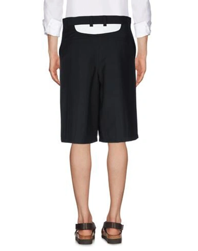 Burberry Bermuda Shorts With Cut-out In Black