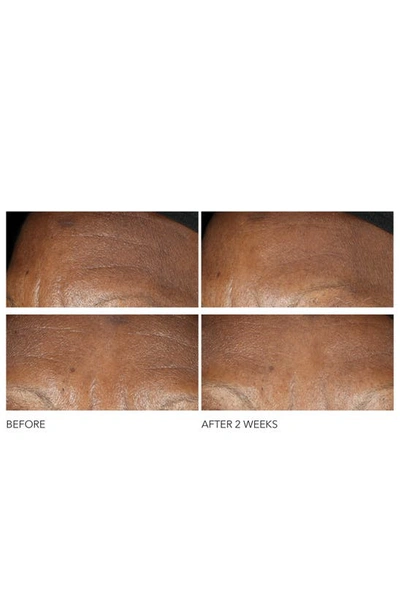 Dr Dennis Gross Skincare Dr. Dennis Gross Skincare Advanced Retinol + Ferulic Intense Wrinkle Cream