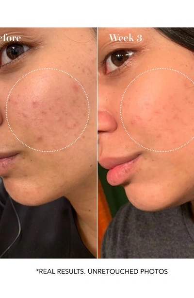 Saturday Skin Pore Clarifying Toner