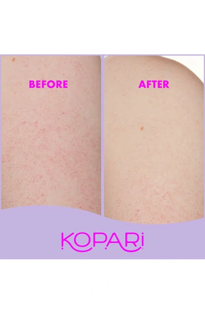 Shop Kopari Kp Body Bumps Be Gone With 10% Aha Exfoliator