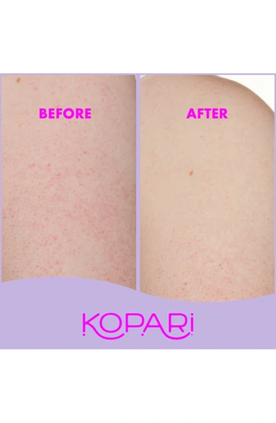 Kopari Kp Body Bumps Be Gone With 10% Aha, Volcanic Sand, Coconut Shells & Green Tea Extract 8.45 oz/ 250 M