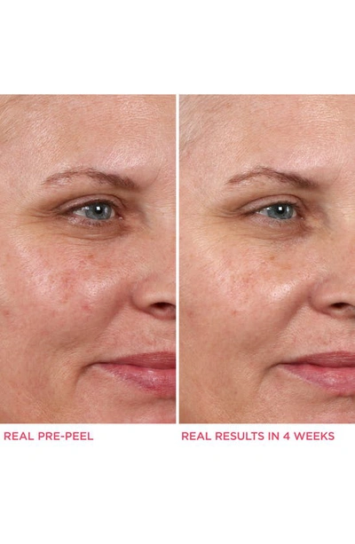 Shop It Cosmetics Hello Results Baby-smooth Glycolic Acid Peel + Caring Oil