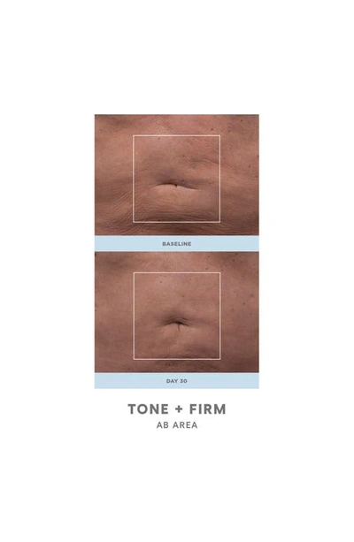 Shop Nuface Nubody® Body Toning Device