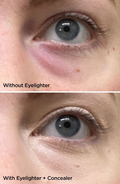 Beautybio The Eyelighter Concentrate With Vitamin C & Plant Powered-retinol 0.5 oz/ 15 ml